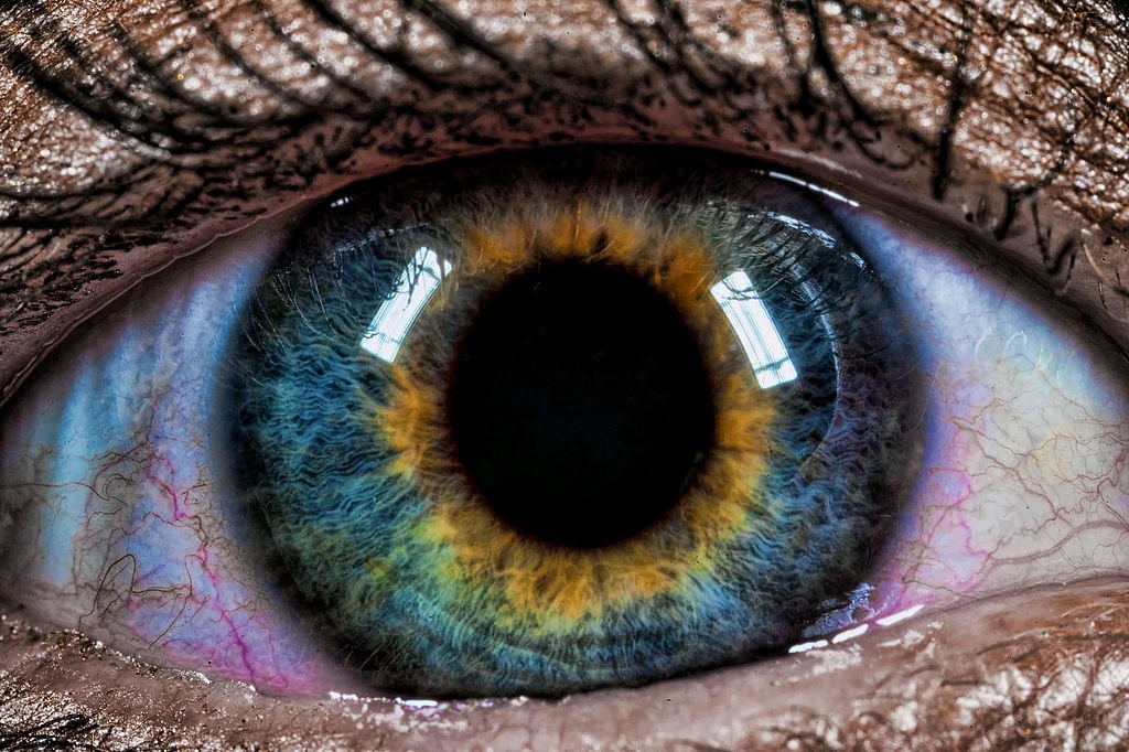 Hermosas mutaciones 15 heterocromia5 fotos impresionantes