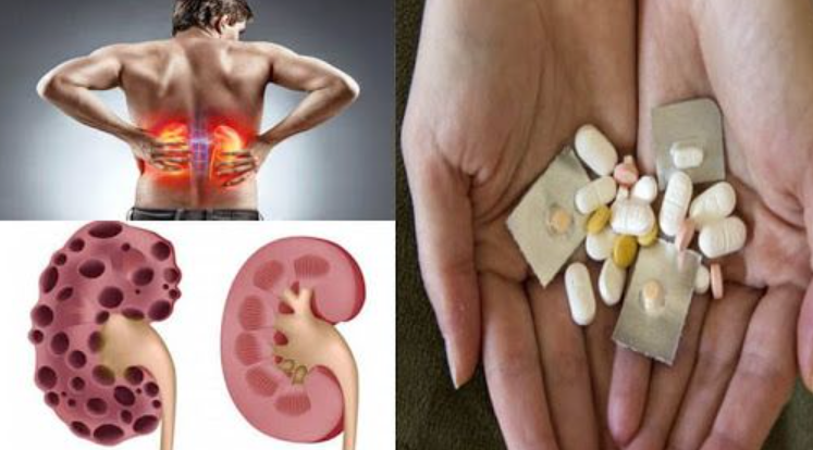 Medicamentos que pueden afectar los riñones